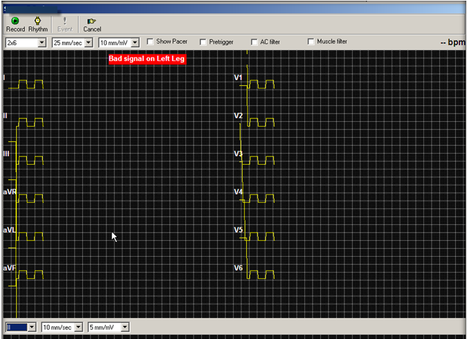 B9e30b28972f7285d4114692000852bb